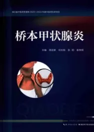 桥本甲状腺炎