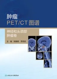 肿瘤PET CT图谱 神经和头颈部肿瘤卷