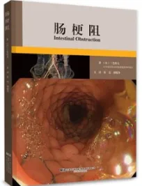 肠梗阻