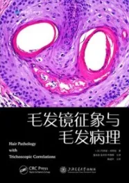 毛发镜征象与毛发病理