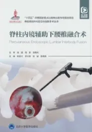脊柱内镜辅助下腰椎融合术