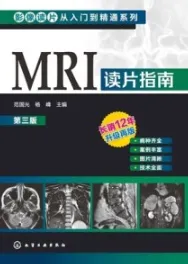 MRI读片指南（第三版）