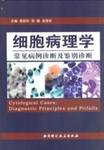 细胞病理学常见病例诊断及鉴别诊断