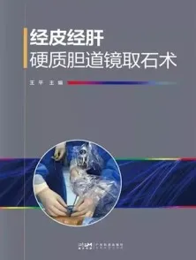 经皮经肝硬质胆道镜取石术