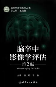 脑卒中影像学评估 第2版
