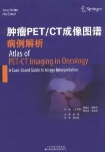 肿瘤PET CT成像图谱病例解析