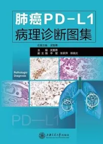 肺癌PD-L1病理诊断图集