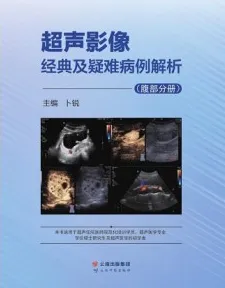 超声影像经典及疑难病例解析 腹部分册