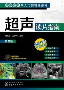 超声读片指南 第3版