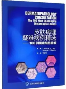 皮肤病理疑难病例精选 100例黑素细胞肿瘤