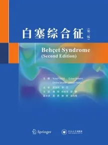 白塞综合征（第二版）