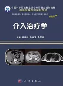 介入治疗学（案例版）