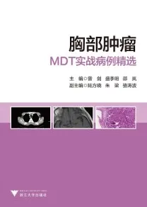 胸部肿瘤MDT实战病例精选