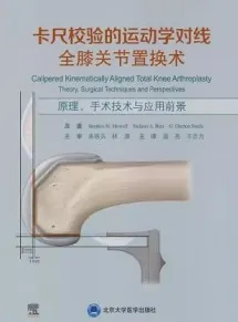 卡尺校验的运动学对线全膝关节置换术 原理、手术技术与应用前景