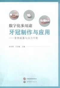 数字化多用途牙冠制作与应用 食物嵌塞与应力中断