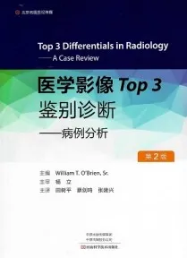 医学影像Top3鉴别诊断 病例分析 第2版
