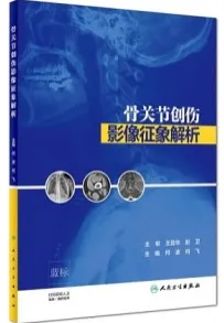 骨关节创伤影像征象解析