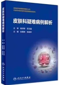 皮肤科疑难病例解析