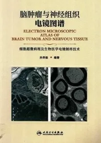 脑肿瘤与神经组织电镜图谱