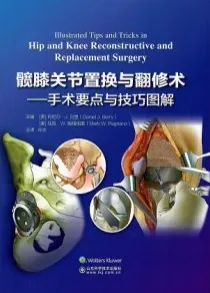 髋膝关节置换与翻修术 手术要点与技巧图解