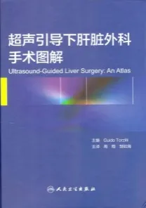 超声引导下肝脏外科手术图解