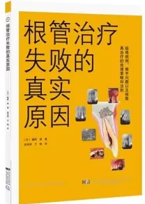 根管治疗失败的真实原因
