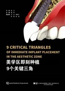 美学区即刻种植9个关键三角