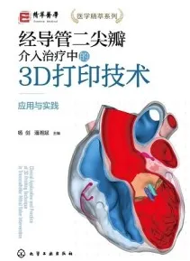 经导管二尖瓣介入治疗中的3D打印技术 应用与实践