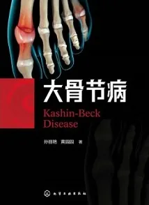 大骨节病
