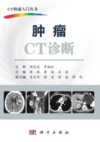 CT快速入门丛书 肿瘤CT诊断