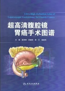 超高清腹腔镜胃癌手术图谱