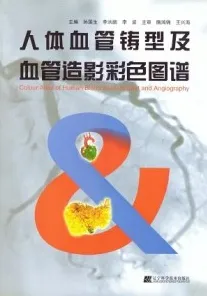 人体血管铸型及血管造影彩色图谱