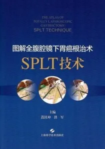 图解全腹腔镜下胃癌根治术