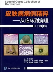 皮肤病病例精粹 从临床到病理 第1辑