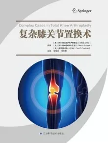 复杂膝关节置换术