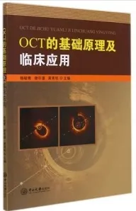 OCT的基础原理及临床应用