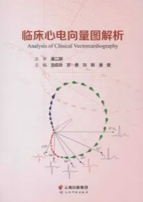 临床心电向量图解析