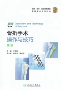 骨折手术操作与技巧 第2版