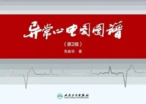 异常心电图图谱（第2版）