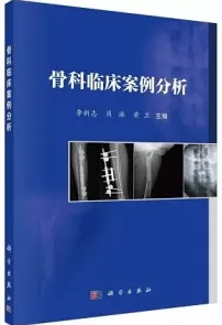 骨科临床案例分析