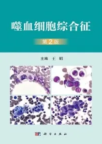 噬血细胞综合征 第2版