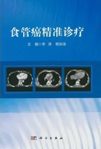 食管癌精准诊疗
