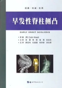 早发性脊柱侧凸
