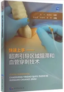 快速上手 超声引导区域阻滞和血管穿刺技术