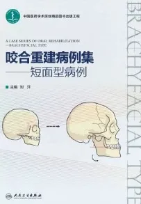 咬合重建病例集 短面型病例