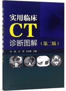 实用临床CT诊断图解 第2版