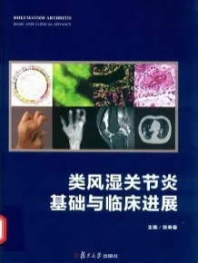 类风湿关节炎 基础与临床进展