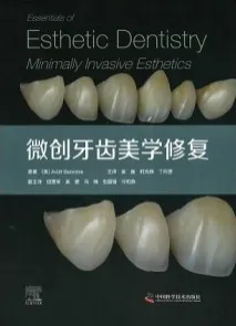 微创牙齿美学修复