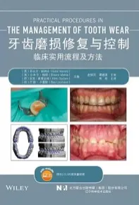 牙齿磨损修复与控制 临床实用流程及方法