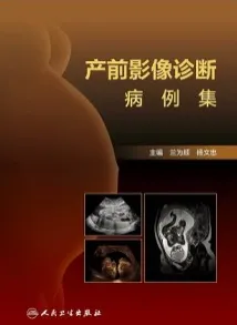 产前影像诊断病例集